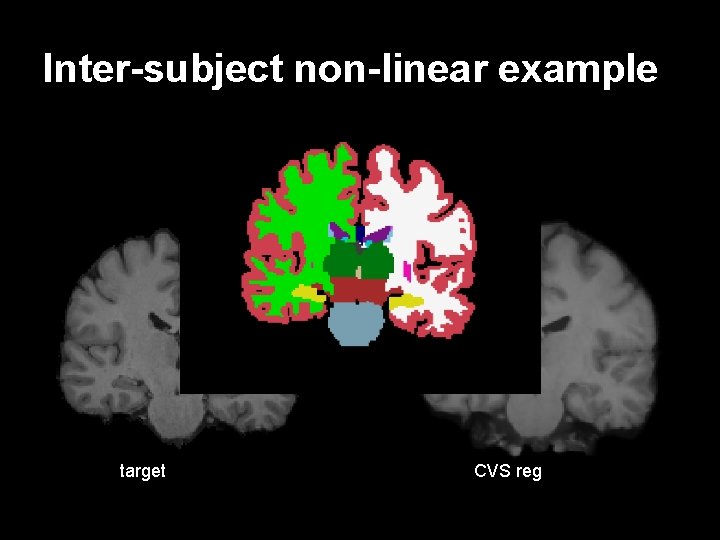 Inter-subject non-linear example target CVS reg 