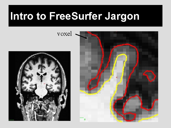 Intro to Free. Surfer Jargon voxel 