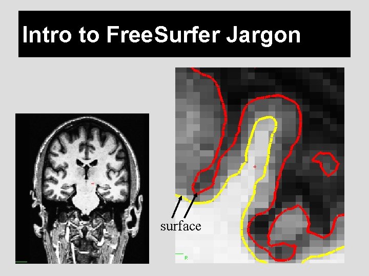 Intro to Free. Surfer Jargon surface 