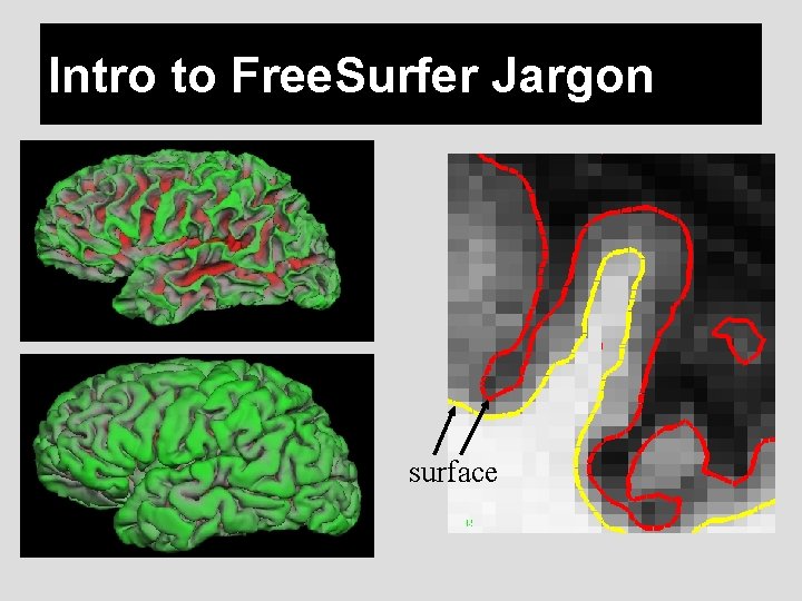 Intro to Free. Surfer Jargon surface 