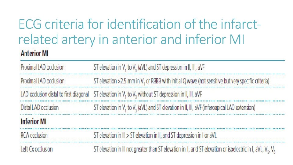 ECG criteria for identification of the infarctrelated artery in anterior and inferior MI 