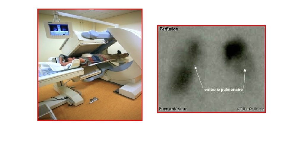 EXPLORATION RADIOLOGIQUE DU CUR ET DES GROS VAISSEAUX