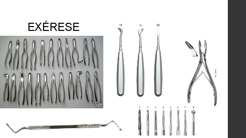 EXÉRESE 
