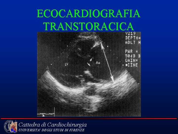 ECOCARDIOGRAFIA TRANSTORACICA Cattedra di Cardiochirurgia UNIVERSITA’ DEGLI STUDI DI FIRENZE 