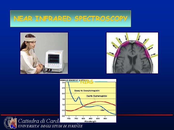 NEAR INFRARED SPECTROSCOPY NIRS Cattedra di Cardiochirurgia UNIVERSITA’ DEGLI STUDI DI FIRENZE 