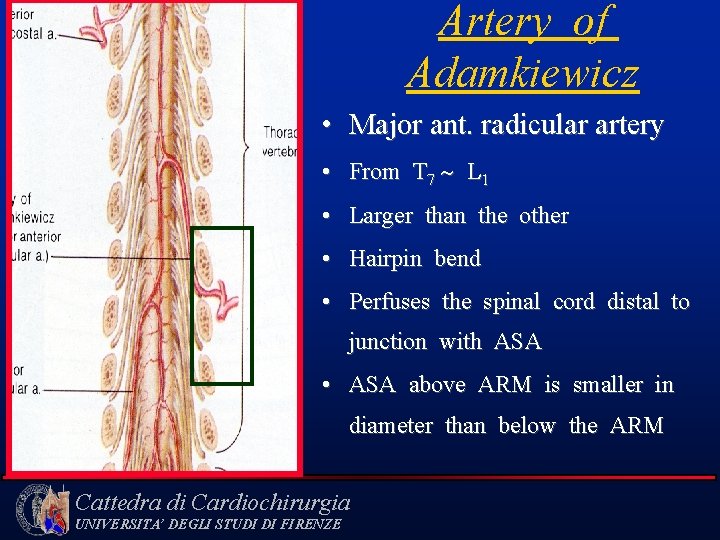 Artery of Adamkiewicz • Major ant. radicular artery • From T 7 L 1