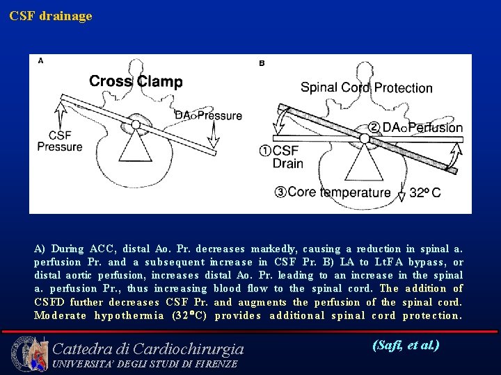 CSF drainage A) During ACC, dis tal Ao. Pr. decreases markedly, causing a reduction