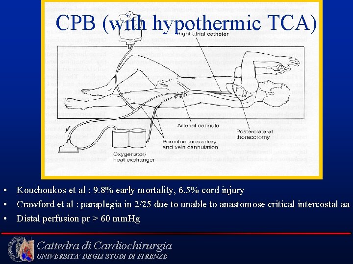 CPB (with hypothermic TCA) • Kouchoukos et al : 9. 8% early mortality, 6.