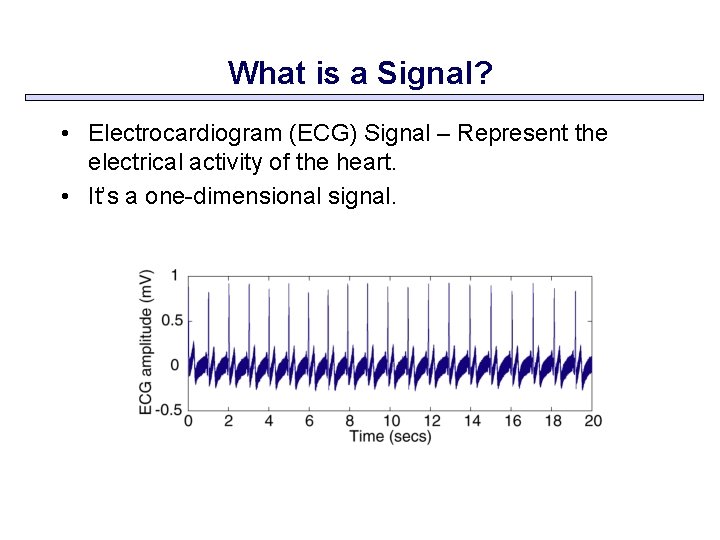 What is a Signal? • Electrocardiogram (ECG) Signal – Represent the electrical activity of