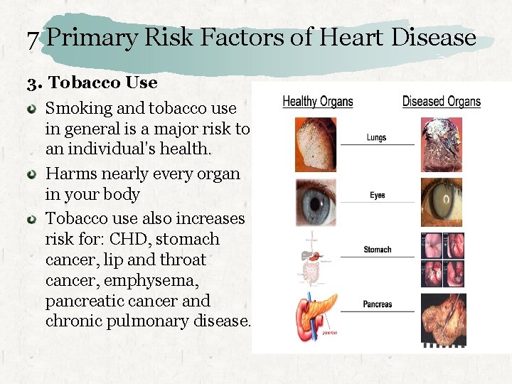 7 Primary Risk Factors of Heart Disease 3. Tobacco Use Smoking and tobacco use