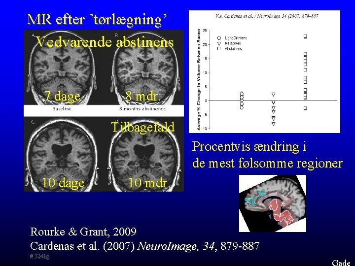 MR efter ’tørlægning’ Vedvarende abstinens 7 dage 8 mdr. Tilbagefald Procentvis ændring i de