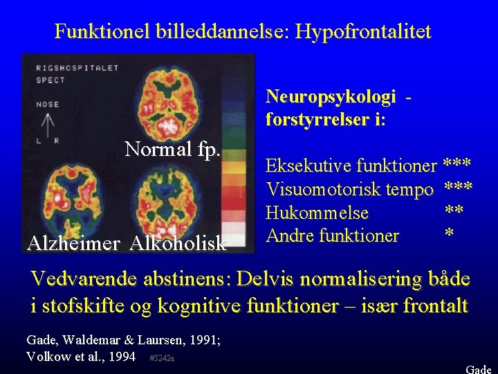 Funktionel billeddannelse: Hypofrontalitet Neuropsykologi forstyrrelser i: Normal fp. Alzheimer Alkoholisk Eksekutive funktioner *** Visuomotorisk