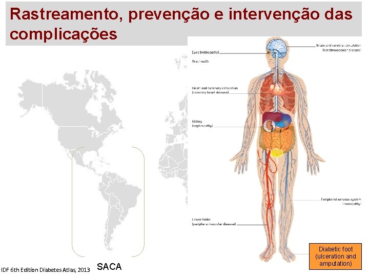 Rastreamento, prevenção e intervenção das complicações IDF 6 th Edition Diabetes Atlas, 2013 SACA