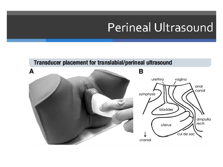 Perineal Ultrasound 