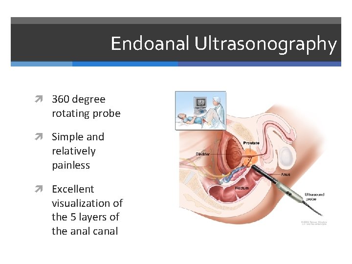 Endoanal Ultrasonography 360 degree rotating probe Simple and relatively painless Excellent visualization of the