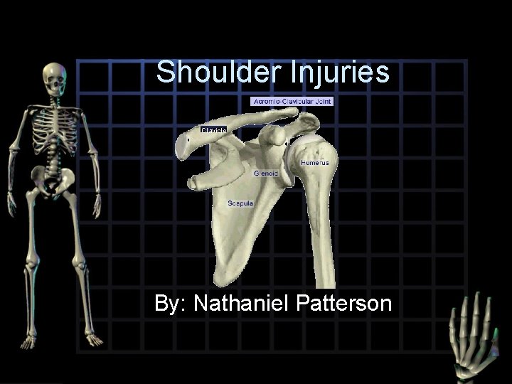 Shoulder Injuries Clavicle By: Nathaniel Patterson 