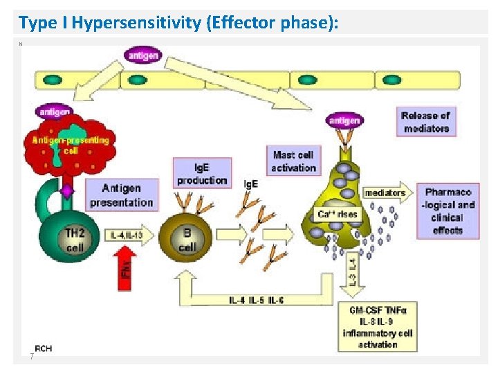 Type I Hypersensitivity (Effector phase): N 7 