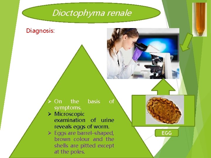 Dioctophyma renale Diagnosis: Ø On the basis of symptoms. Ø Microscopic examination of urine