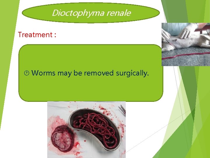 Dioctophyma renale Treatment : Worms may be removed surgically. 