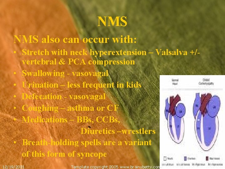 NMS also can occur with: • Stretch with neck hyperextension – Valsalva +/vertebral &