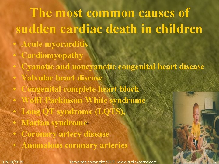 The most common causes of sudden cardiac death in children • • • Acute