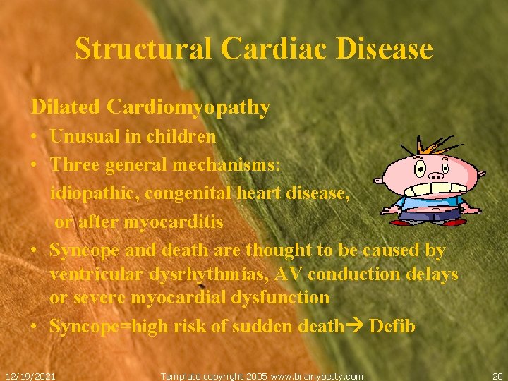 Structural Cardiac Disease Dilated Cardiomyopathy • Unusual in children • Three general mechanisms: idiopathic,