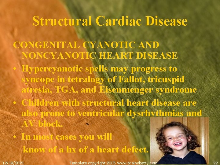 Structural Cardiac Disease CONGENITAL CYANOTIC AND NONCYANOTIC HEART DISEASE • Hypercyanotic spells may progress