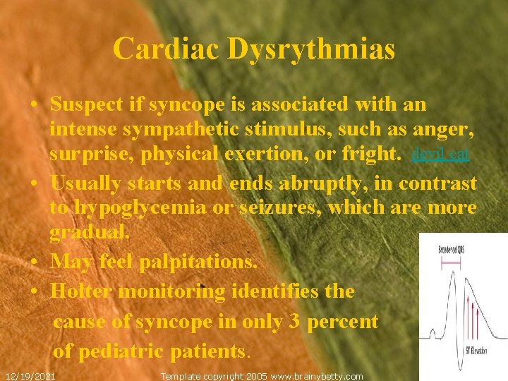 Cardiac Dysrythmias • Suspect if syncope is associated with an intense sympathetic stimulus, such