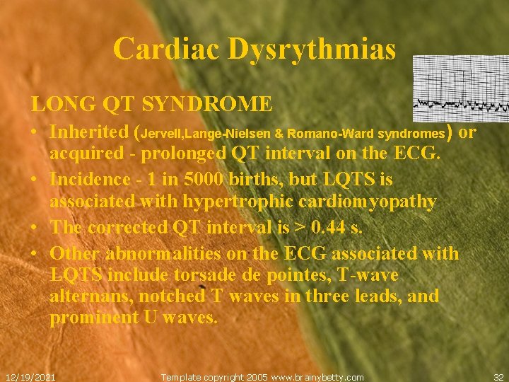 Cardiac Dysrythmias LONG QT SYNDROME • Inherited (Jervell, Lange-Nielsen & Romano-Ward syndromes) or acquired