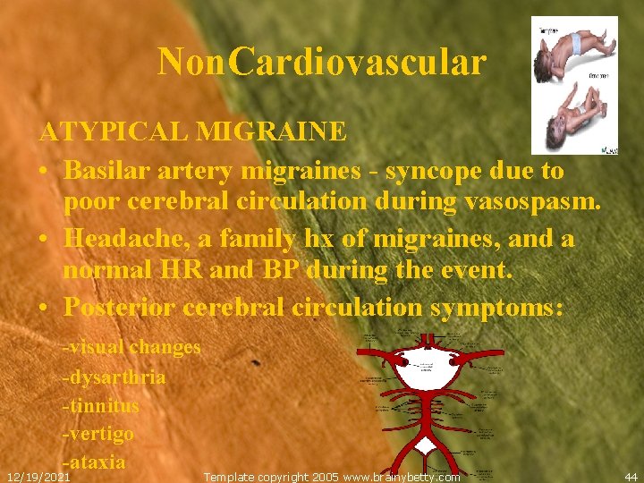 Non. Cardiovascular ATYPICAL MIGRAINE • Basilar artery migraines - syncope due to poor cerebral