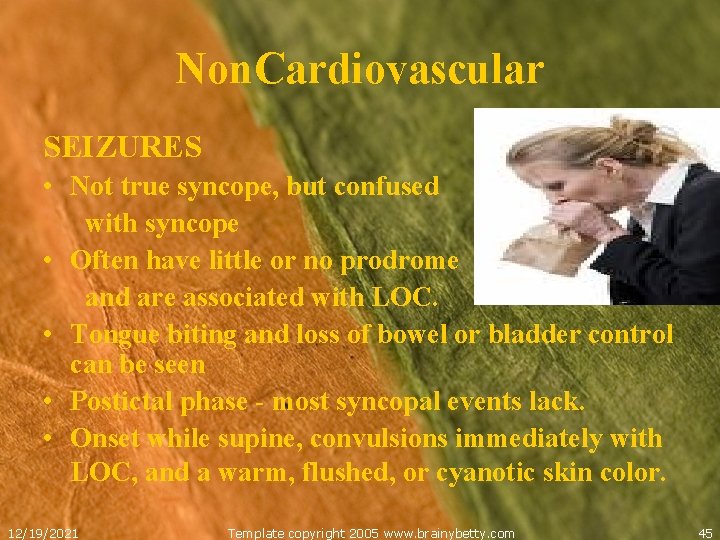 Non. Cardiovascular SEIZURES • Not true syncope, but confused with syncope • Often have