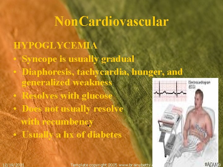 Non. Cardiovascular HYPOGLYCEMIA • Syncope is usually gradual • Diaphoresis, tachycardia, hunger, and generalized