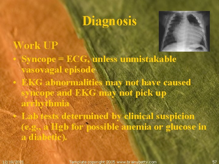 Diagnosis Work UP • Syncope = ECG, unless unmistakable vasovagal episode • EKG abnormalities