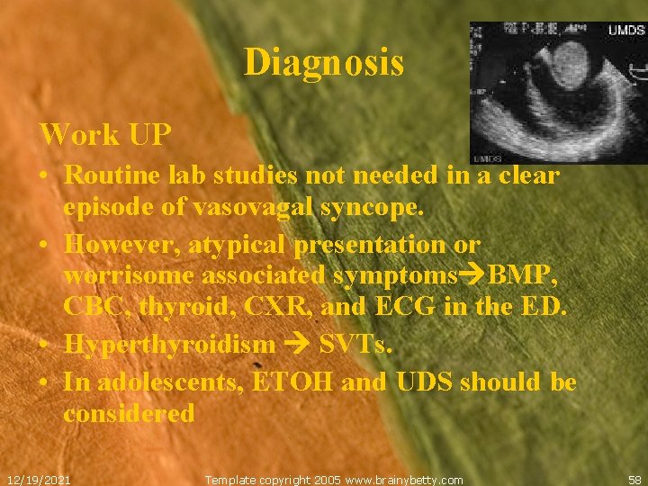 Diagnosis Work UP • Routine lab studies not needed in a clear episode of