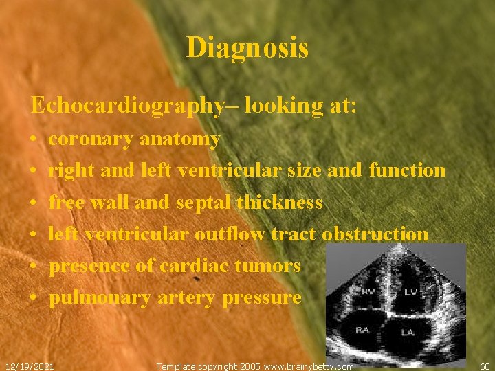 Diagnosis Echocardiography– looking at: • • • coronary anatomy right and left ventricular size
