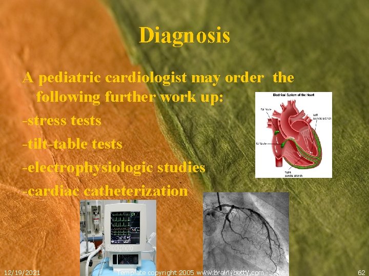 Diagnosis A pediatric cardiologist may order the following further work up: -stress tests -tilt-table