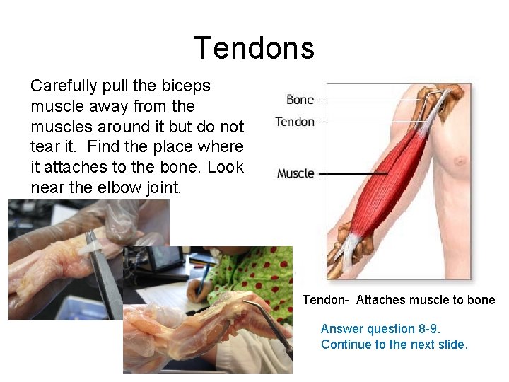 Tendons Carefully pull the biceps muscle away from the muscles around it but do