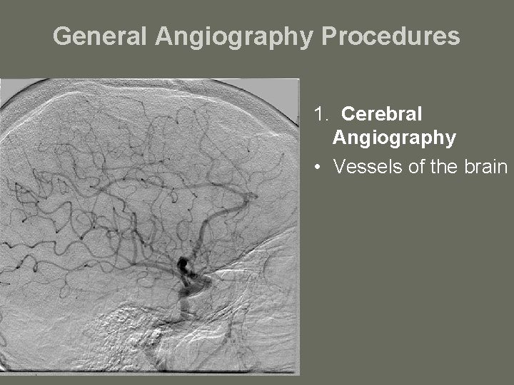 General Angiography Procedures 1. Cerebral Angiography • Vessels of the brain 