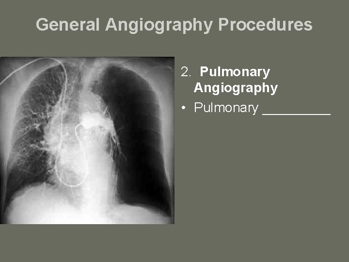 General Angiography Procedures 2. Pulmonary Angiography • Pulmonary _____ 
