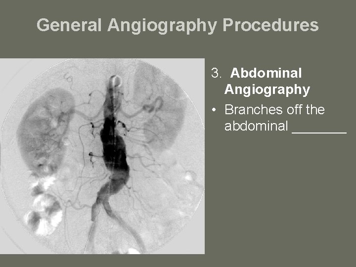 General Angiography Procedures 3. Abdominal Angiography • Branches off the abdominal _______ 