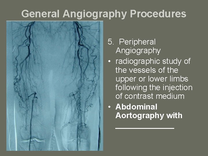 General Angiography Procedures 5. Peripheral Angiography • radiographic study of the vessels of the