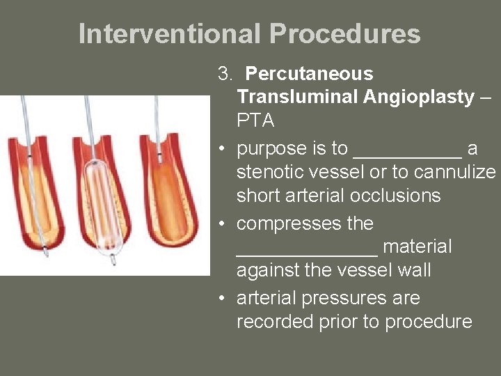 Interventional Procedures 3. Percutaneous Transluminal Angioplasty – PTA • purpose is to _____ a