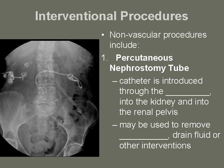 Interventional Procedures • Non-vascular procedures include: 1. Percutaneous Nephrostomy Tube – catheter is introduced