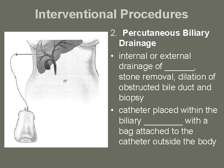 Interventional Procedures 2. Percutaneous Biliary Drainage • internal or external drainage of ______, stone