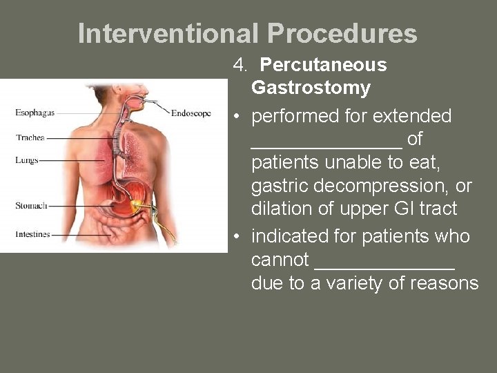 Interventional Procedures 4. Percutaneous Gastrostomy • performed for extended _______ of patients unable to