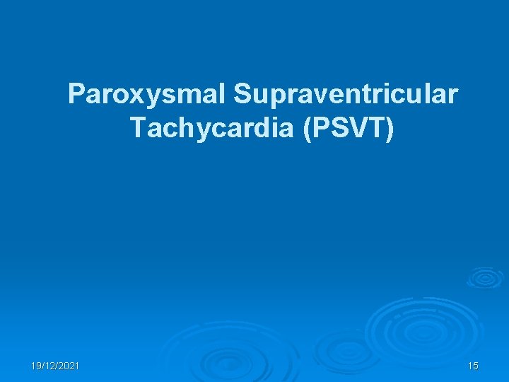 Paroxysmal Supraventricular Tachycardia (PSVT) 19/12/2021 15 