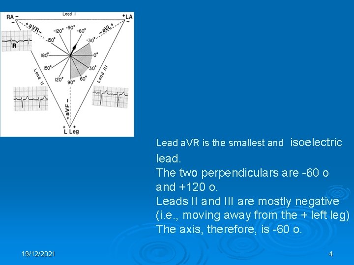 Lead a. VR is the smallest and isoelectric lead. The two perpendiculars are -60