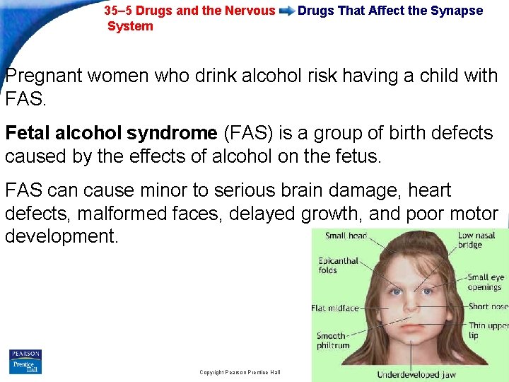 35– 5 Drugs and the Nervous System Drugs That Affect the Synapse Pregnant women