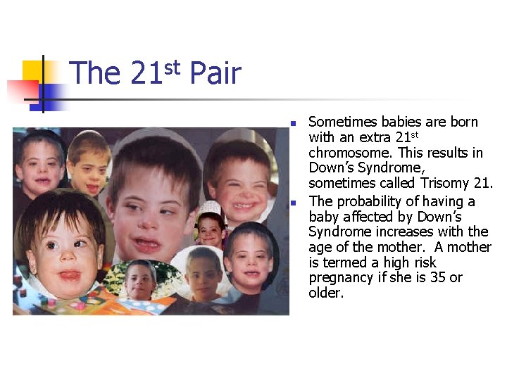 The 21 st Pair n n Sometimes babies are born with an extra 21