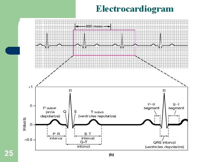 Electrocardiogram 25 